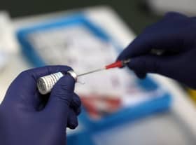 The World Health Organisation has confirmed that monkeypox has been renamed ‘mpox’ following racism concerns.