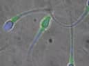 The new pill ‘stuns’ sperm, making them unable to swim to an egg.