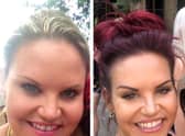 Kate Richmond's before and after photos from her incredible weight loss journey