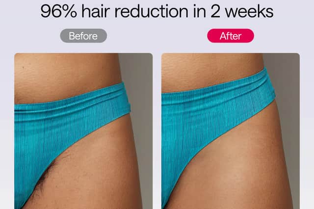 Ulike Air 10 Hair Laser Removal Device