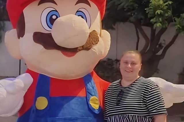 Before weight loss 