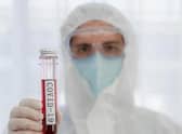 Test and trace capacity in Lincolnshire has been scaled back.