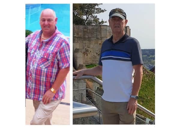 Before - and after