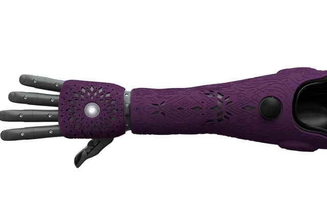 An example of how the new bionic arm will look. EMN-210125-181339001