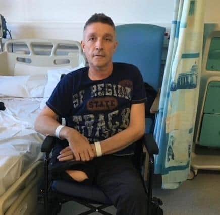 Andrew Pearson in hospital after his amputation. EMN-210302-101430001