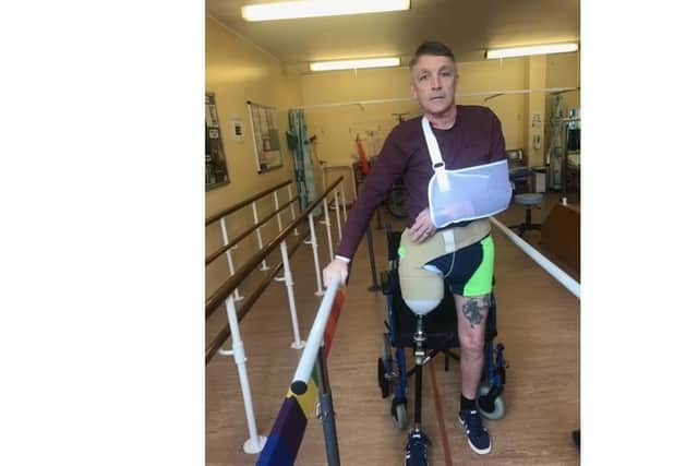 Andrew during his year of rehabilitation after the motorcycle crash. EMN-210302-102738001