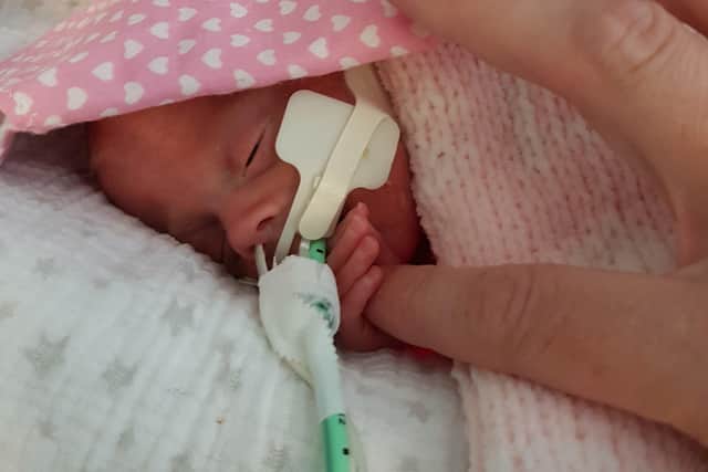 Georgia spent the first few months of her life in hospital