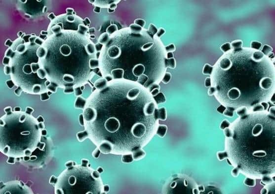 Coronavirus.
