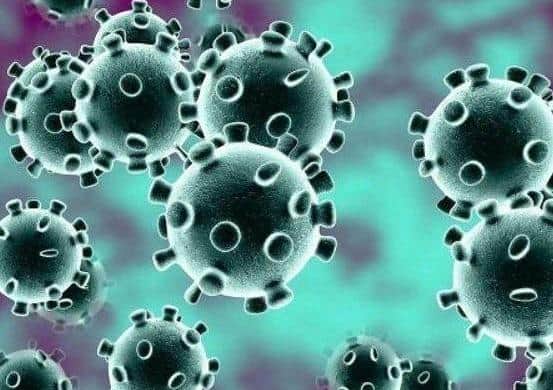 Coronavirus (covid-19)