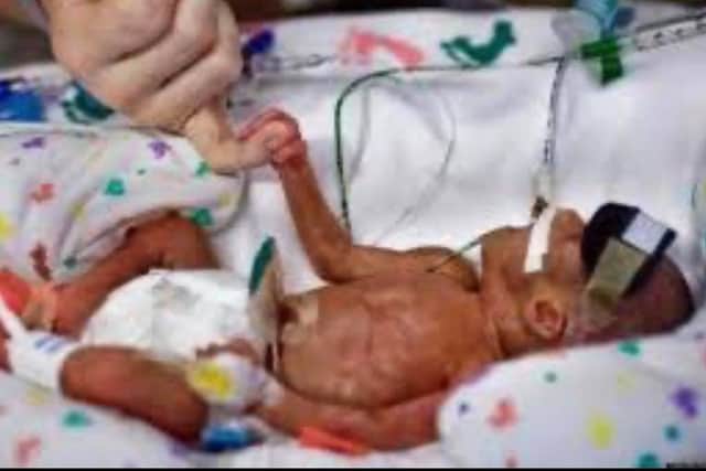 An auction is to be held to raise funds for the Neonatal Intensive Care Unit at the Diana, Princess of Wales Hospital in Grimsby.