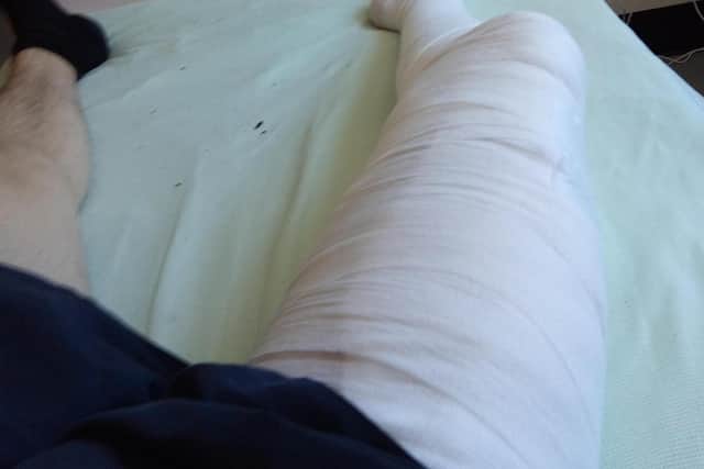 Connor Degnan's leg bandaged EMN-200806-141223001