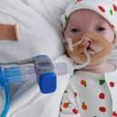 Little Dottie is in intensive care in hospital but her family and the local community are campaigning to bring her home.