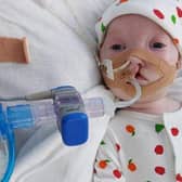 Little Dottie is in intensive care in hospital but her family and the local community are campaigning to bring her home.