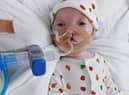 Little Dottie is in intensive care in hospital but her family and the local community are campaigning to bring her home.