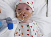 Little Dottie is in intensive care in hospital but her family and the local community are campaigning to bring her home.