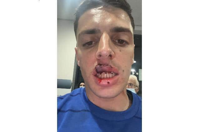 Scott Duxbury received 30-plus stitches.