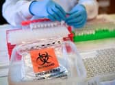 Coronavirus stock image