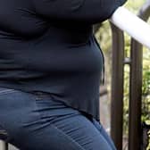 More people are being admitted to hospital as a result of obesity in North East Lincolnshire, new figures show.