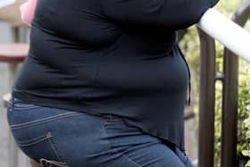 More people are being admitted to hospital as a result of obesity in North East Lincolnshire, new figures show.