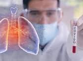 Coronavirus    (stock image)