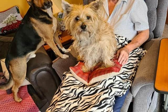 Carolyn's dad died of vascular ehlers danlos syndrome in May - the same disease she has.