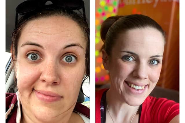 Another before and after comparison.