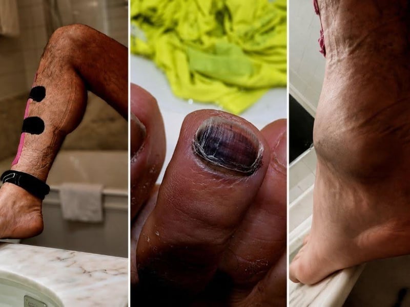 Some of Greg's injuries.