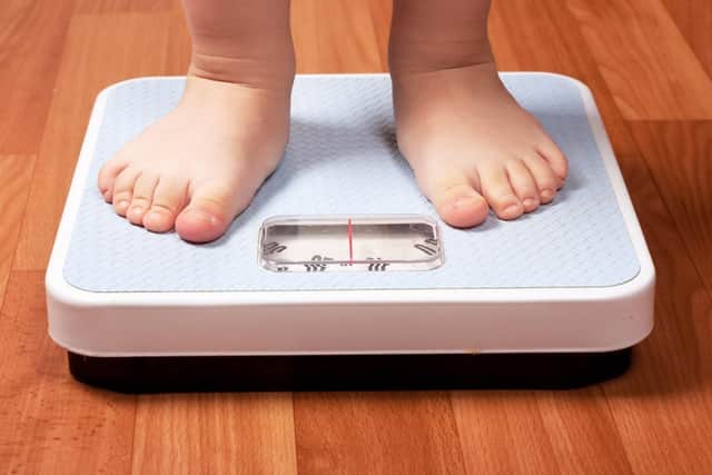 Child obesity