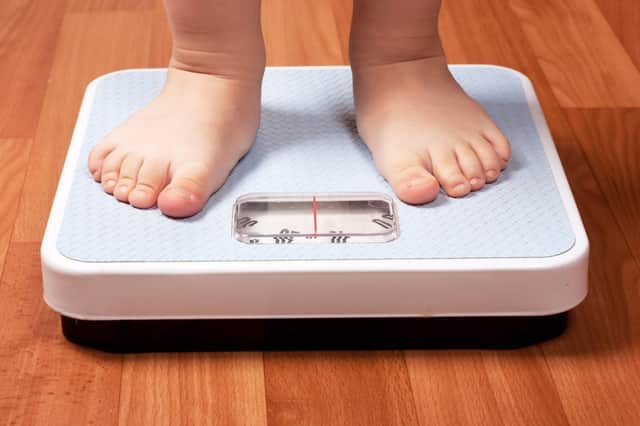 Child obesity
