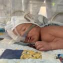Baby Jack on the  CPAP machine at Lincoln County Hospital.