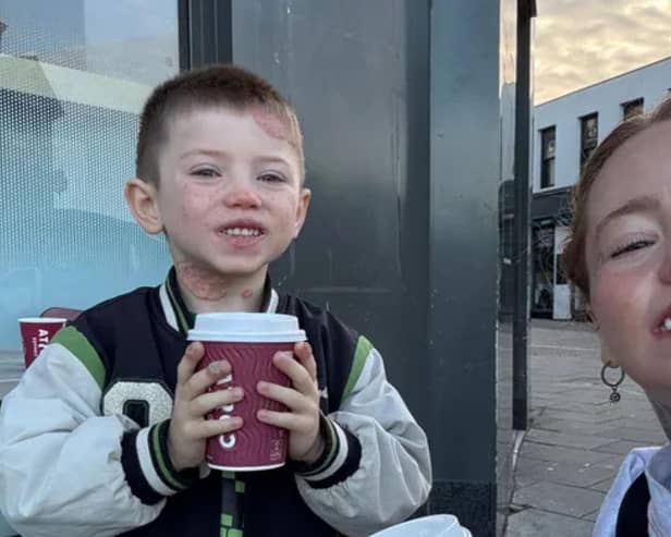 Clay pictured with his mum, Danni-Lea.