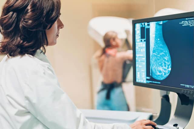A free breast-screening service will be available in Louth for women over 50 from next year (PHOTO BY: Getty Images)