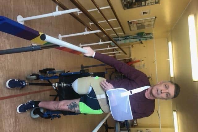 Andrew Pearson after his amputation.
