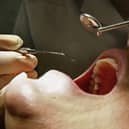Lincolnshire is expected to provide another 12,000 emergency dental appointments. (Photo by Jeff J Mitchell/Getty Images)
