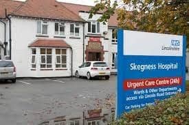 The new community diagnostic centres (CDCs) will build on the services offered by Skegness Hospital.