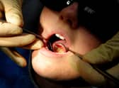 File photo dated 19/05/11 of a dentist at work. Adding fluoride to water supplies offers only a modest benefit to the dental health of children, researchers have found. The scientists said water fluoridation can be seen as a cost-effective way to help reduce some of the £1.7 billion a year the NHS spends on dental caries. Issue date: Monday November 14, 2022.