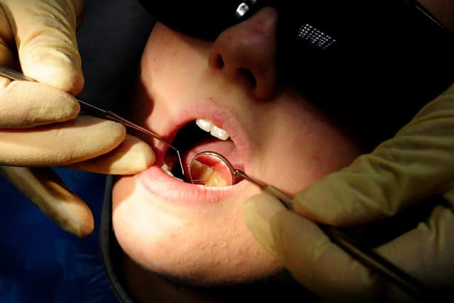 File photo dated 19/05/11 of a dentist at work. Adding fluoride to water supplies offers only a modest benefit to the dental health of children, researchers have found. The scientists said water fluoridation can be seen as a cost-effective way to help reduce some of the £1.7 billion a year the NHS spends on dental caries. Issue date: Monday November 14, 2022.