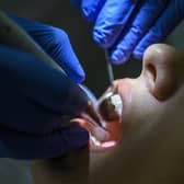 Boston is facing a 'dental timebomb' according to a survey by Dental Phobia. Photo for illustration only. (Getty Images)