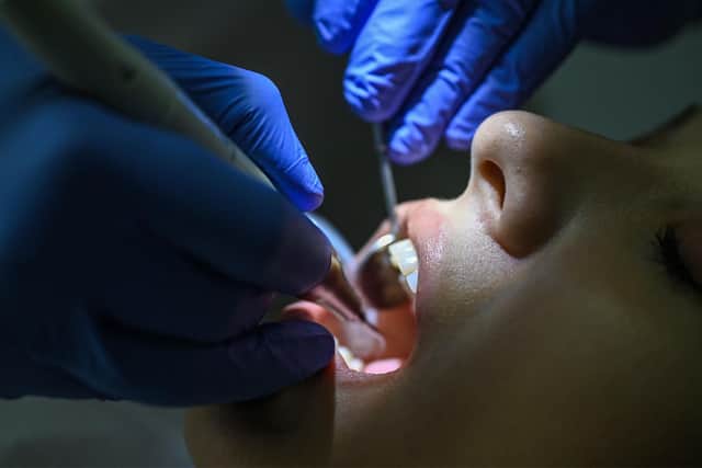 Boston is facing a 'dental timebomb' according to a survey by Dental Phobia. Photo for illustration only. (Getty Images)
