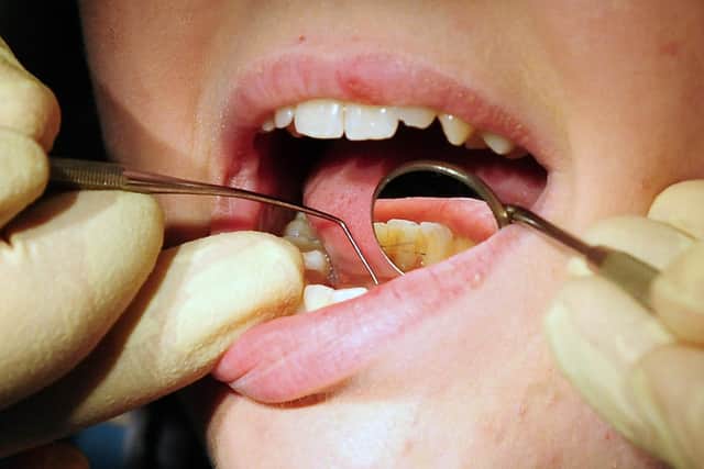 File photo dated 19/05/11 of a dentist at work. People in the UK have been forced to pull out their own teeth at home because they can not access or afford an NHS dentist, a damning new report from the Health and Social Care Committee has found.