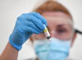 The Government has bowed to pressure from local public health officials to release full coronavirus testing data.