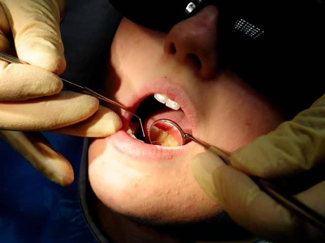 File photo dated 19/05/11 of a dentist at work. Millions of children in England were not seen by an NHS dentist last year, new figures show. Data obtained by the Liberal Democrats show that 4.4 million children in England were not seen by an NHS dentist in the year to June 2023. Issue date: Tuesday September 19, 2023.