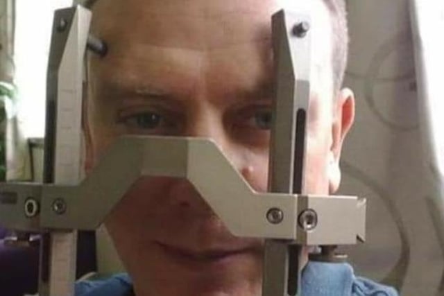 Wayne Chessum undergoing Gamma Knife Radiotherapy.