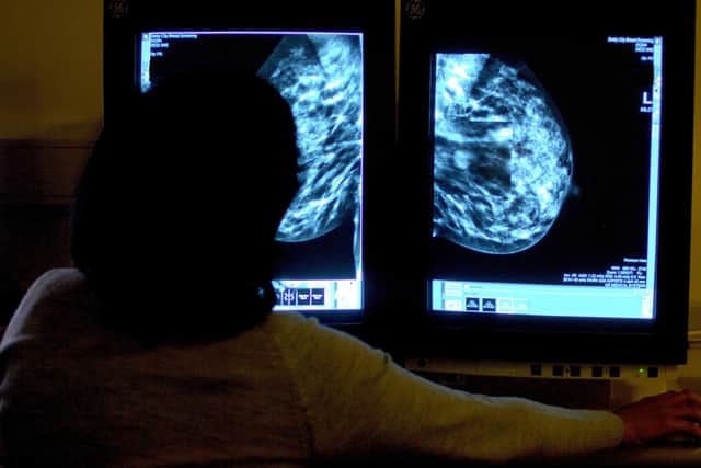File photo dated 15/06/06 of a consultant studying a mammogram of a woman's breast, as more women will be able to get checked for breast cancer after the Government announced £10 million for new NHS screening units, the Department of Health and Social Care said.