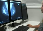 Viewing a mammorgram on screen.
