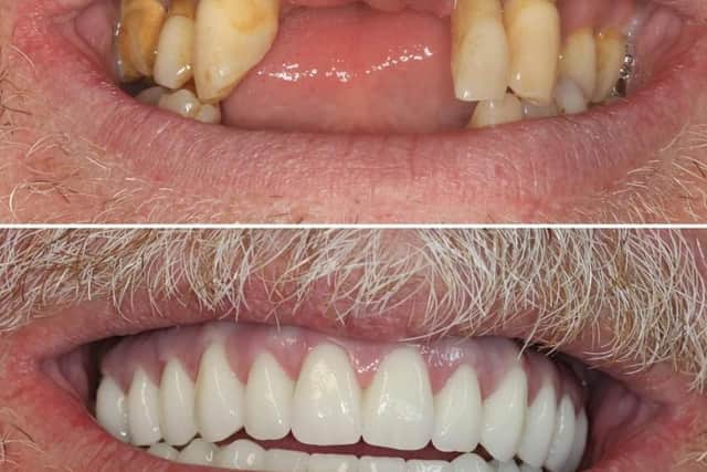 Life-changing dental treatment could bring back your confidence to smile again