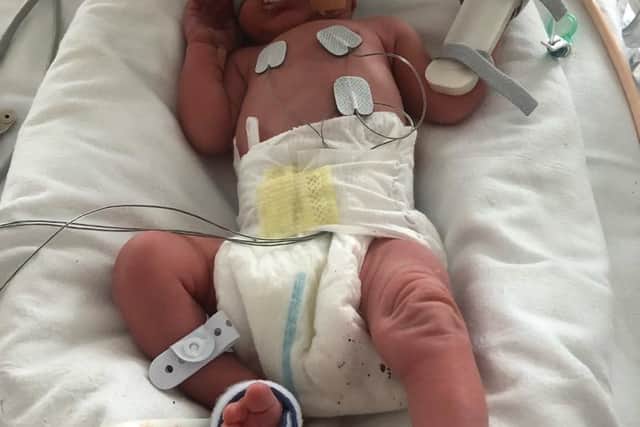 Charlie was born at 34 weeks so Charlotte could begin her cancer treatment.