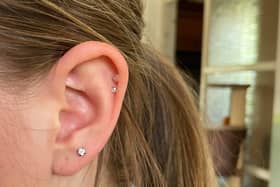 Olivia Roby was suspended from Skegness Academy for wearing plastic retainers.