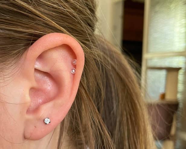 Olivia Roby was suspended from Skegness Academy for wearing plastic retainers.