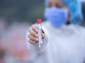 Health bosses have not yet had to use any pub or restaurant Covid-19 contact tracing data